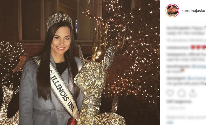 Ünlü model kanser atlattı Şans eseri öğrenmişti Ünlü model kanser atlattı Şans eseri öğrenmişti