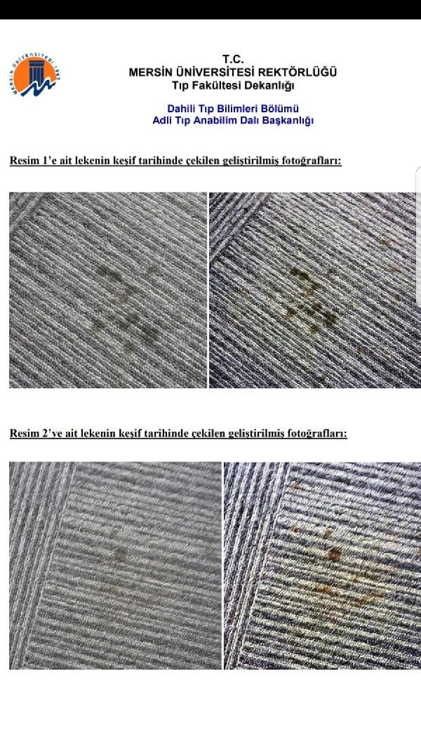 Şule Çet davası… İşte bilimsel raporda yer alan o lekeler…