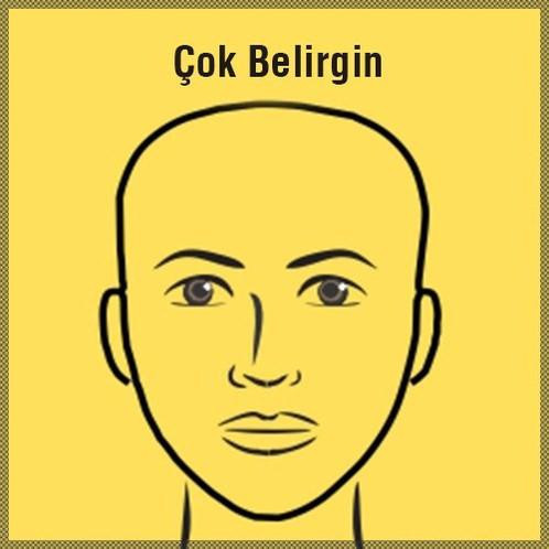 Çok belirgin alın: