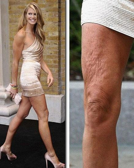 Bayan vücut sarktı