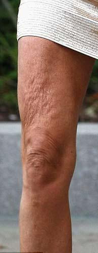 Bayan vücut sarktı