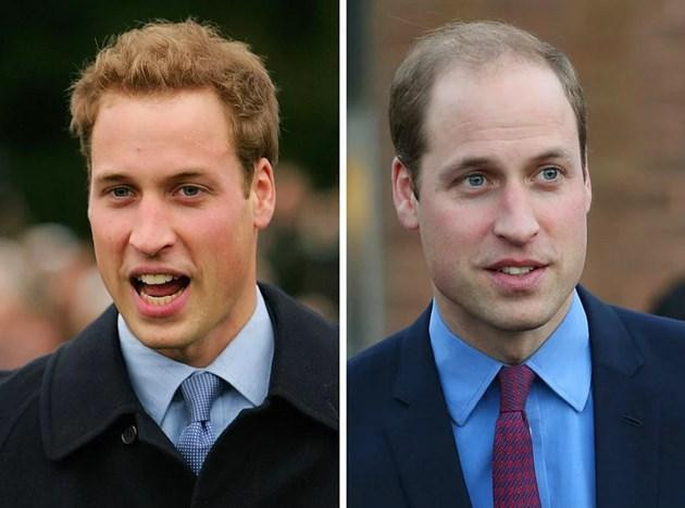 Hollywood Ünlülelerinin 10 Yıllık Değişimi