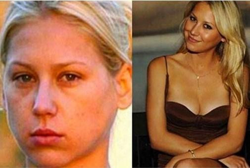 Ünlülerin Moral Bozan Makyajsız Halleri