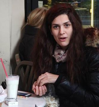 Hiç estetik operasyon geçirmediler