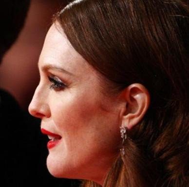 Hiç estetik operasyon geçirmediler