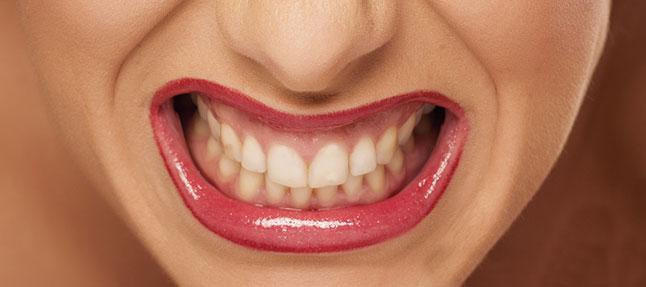 Boyun Ağrısına Engel Olmanın 9 Yolu