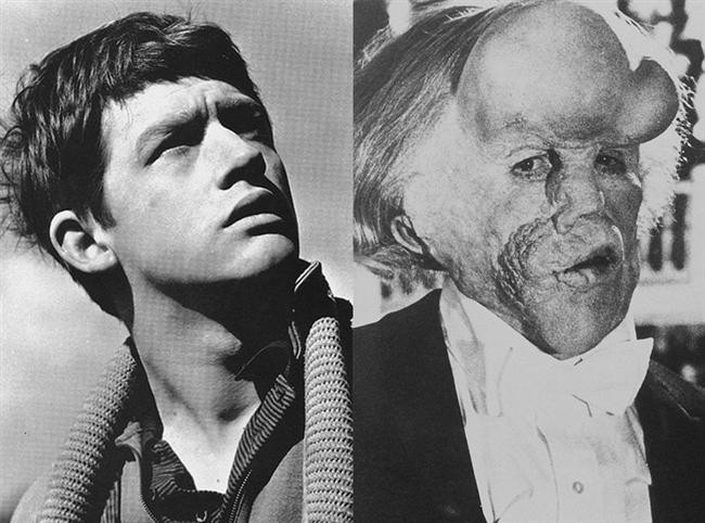 John Hurt - Fil Adam / The Elephant Man (1980)
