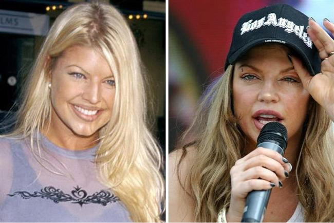 Kötü Alışkanlıkları Yüzünden Bu Hale Geldiler