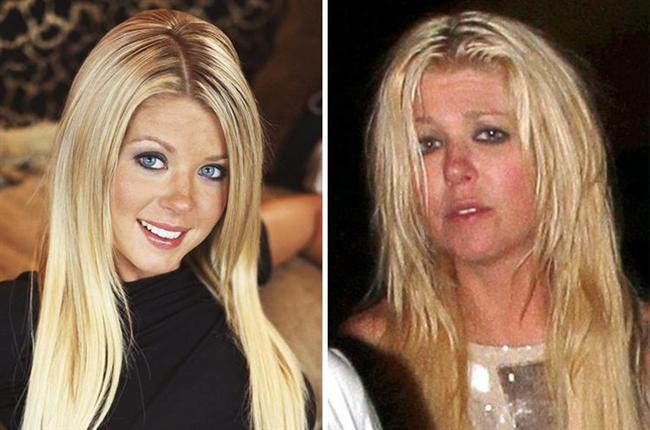 Kötü Alışkanlıkları Yüzünden Bu Hale Geldiler