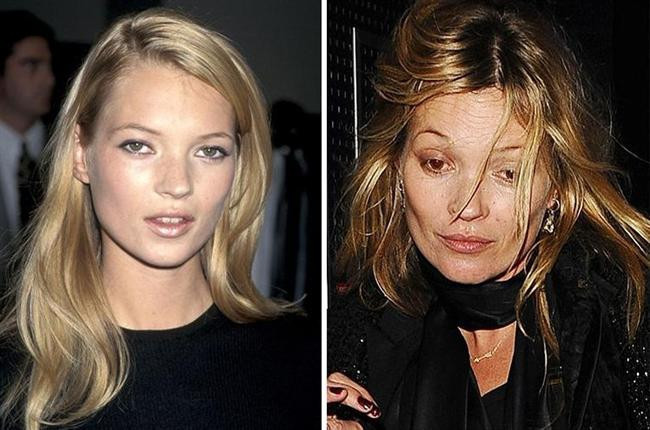 Kötü Alışkanlıkları Yüzünden Bu Hale Geldiler