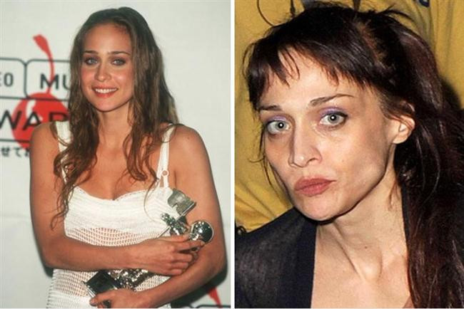 Kötü Alışkanlıkları Yüzünden Bu Hale Geldiler