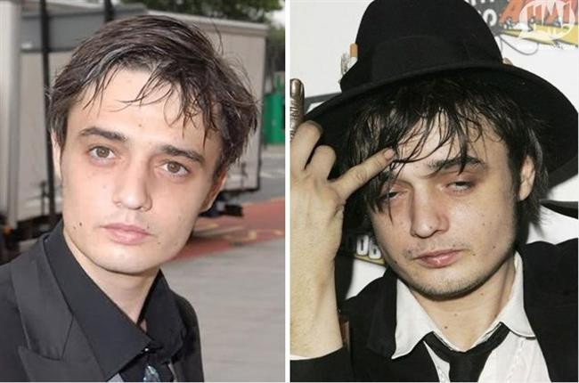 Kötü Alışkanlıkları Yüzünden Bu Hale Geldiler