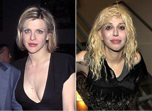 Kötü Alışkanlıkları Yüzünden Bu Hale Geldiler