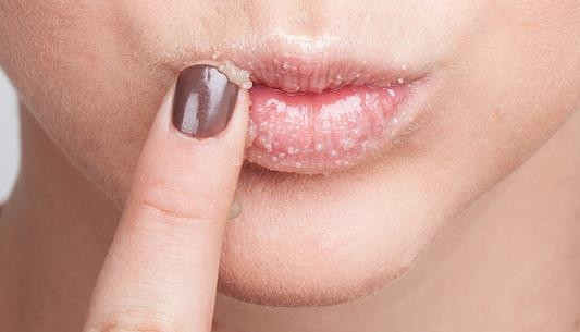 Dudaklara şeker peelingi