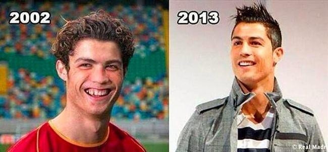 Ünlülerin Nasıl Değiştiğini Gösteren 19 Fotoğraf