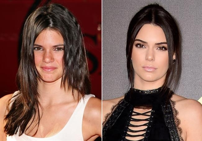 Kardashian ve Jenner Kadınlarının Değişimi