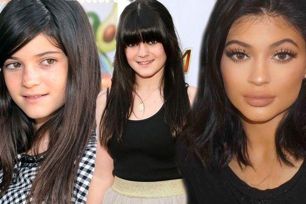 Kardashian ve Jenner Kadınlarının Değişimi