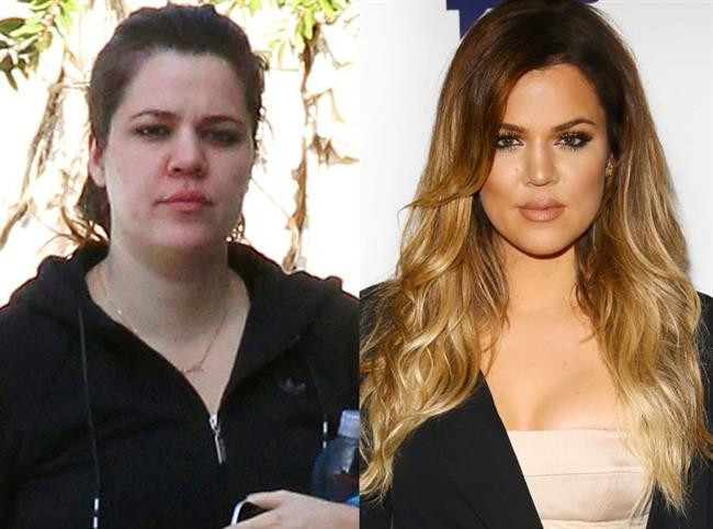 Kardashian ve Jenner Kadınlarının Değişimi