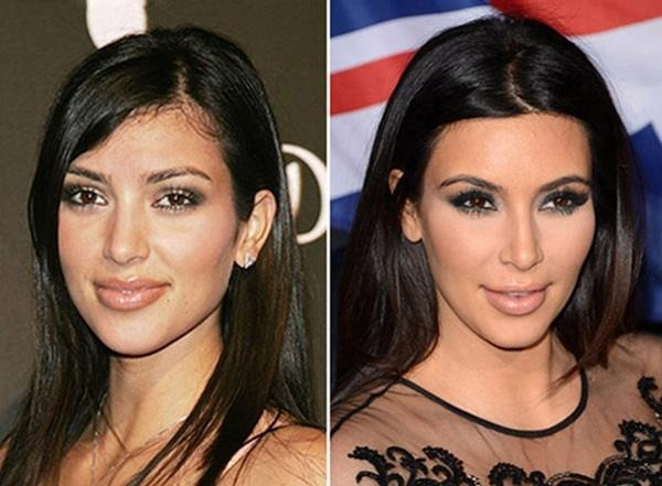 Kardashian ve Jenner Kadınlarının Değişimi