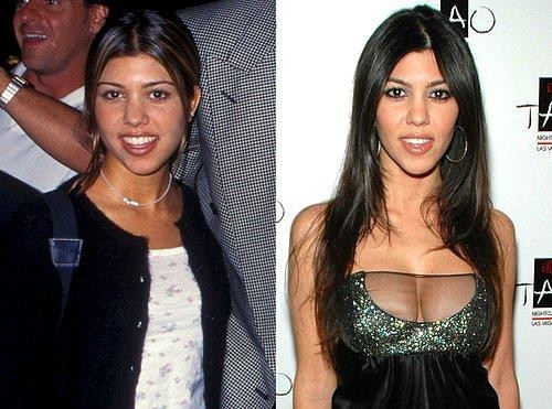 Kardashian ve Jenner Kadınlarının Değişimi