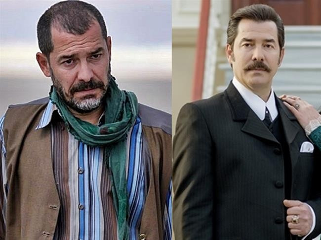 Kel Kalmak İstemeyip Saç Ektiren Ünlüler
