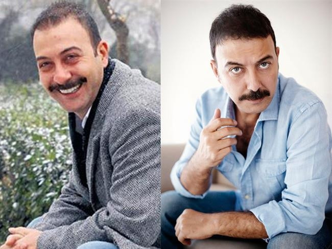 Kel Kalmak İstemeyip Saç Ektiren Ünlüler