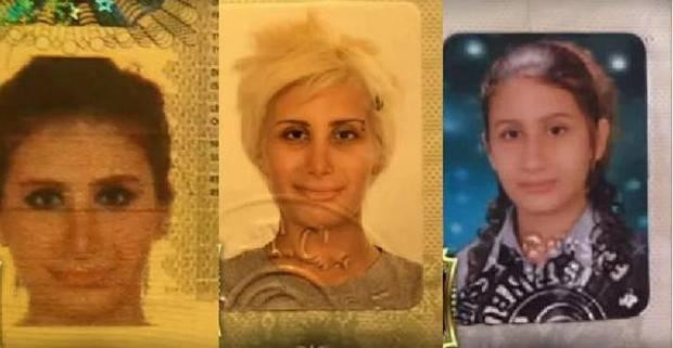 Ünlülerin Estetiksiz Halleri Şaşırttı
