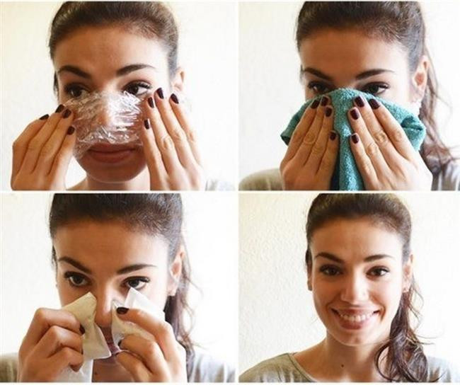 Burnunuza Streç Film Sararsanız...