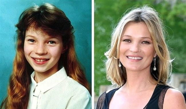 Kate Moss