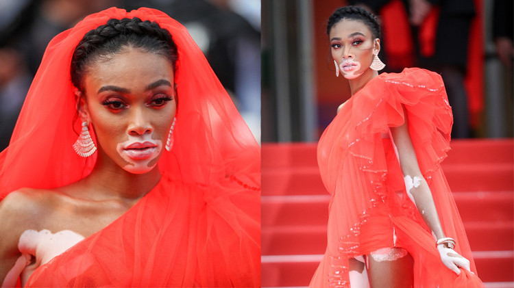 Güzellik Algısını Baştan Yaratan Kadın: Winnie Harlow Güzellik Algısını Baştan Yaratan Kadın: Winnie Harlow