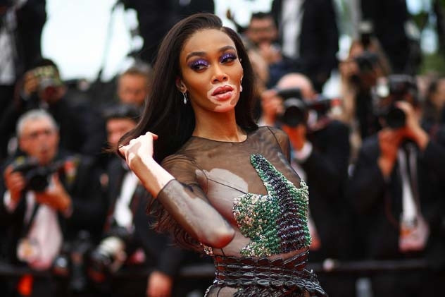 Güzellik Algısını Baştan Yaratan Kadın: Winnie Harlow Güzellik Algısını Baştan Yaratan Kadın: Winnie Harlow