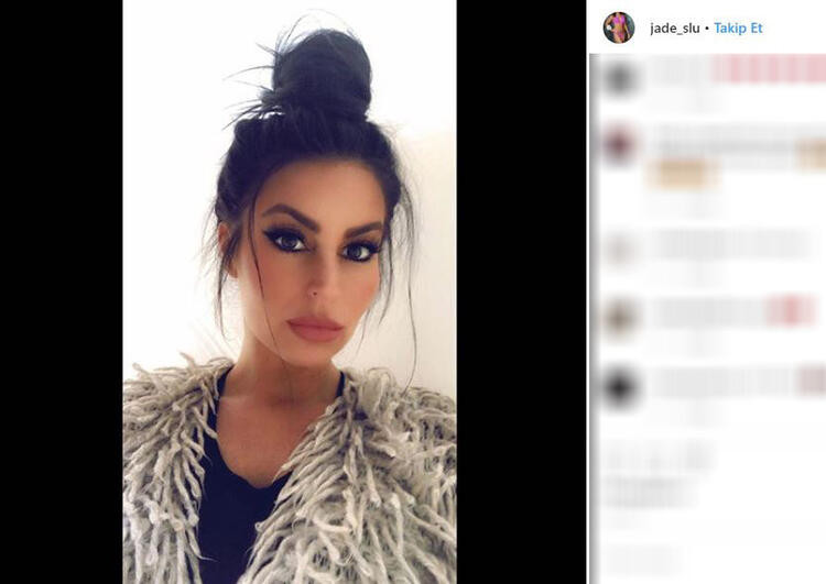 Güzellik kraliçesinin şoke eden görüntüsü... Barda kafasında şişe kırıldı