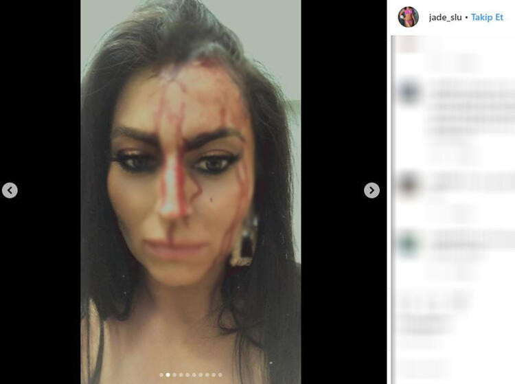 Güzellik kraliçesinin şoke eden görüntüsü... Barda kafasında şişe kırıldı