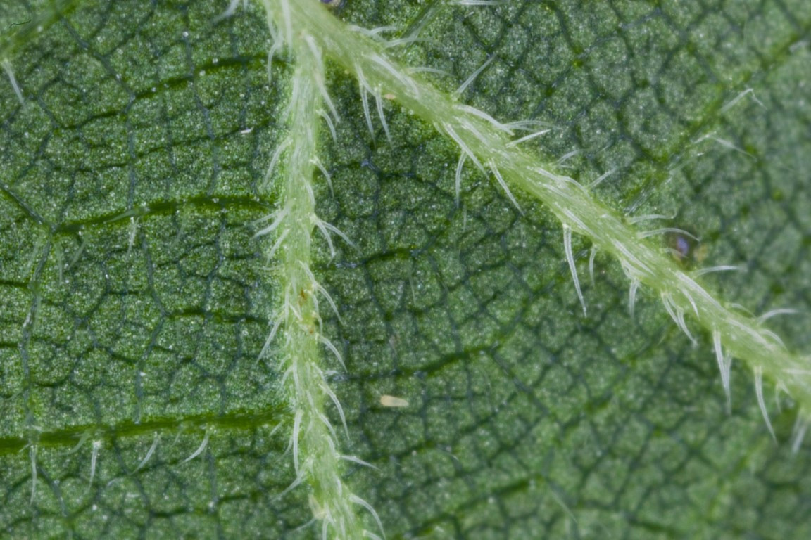 D vitamini nedir D vitamini eksikliği Tedavisi nasıl olur