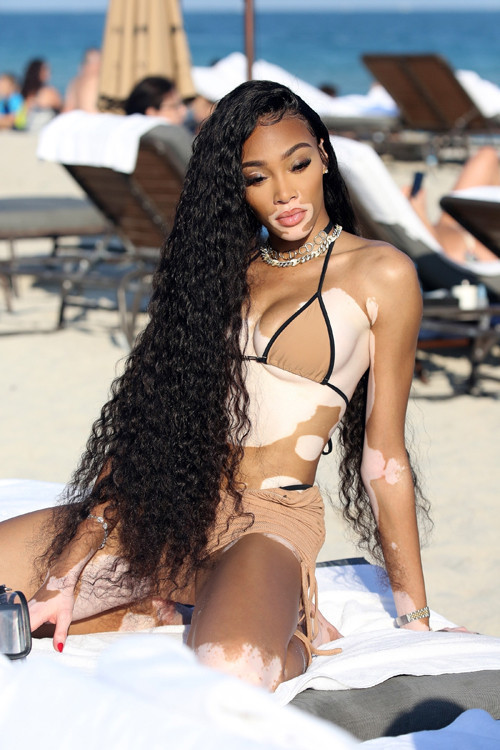 Winnie Harlow: Küçükken alay ederlerdi, şimdi milyon dolarlık servetin sahibi Winnie Harlow: Küçükken alay ederlerdi, şimdi milyon dolarlık servetin sahibi