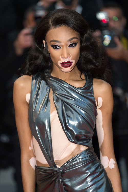 Winnie Harlow: Küçükken alay ederlerdi, şimdi milyon dolarlık servetin sahibi Winnie Harlow: Küçükken alay ederlerdi, şimdi milyon dolarlık servetin sahibi