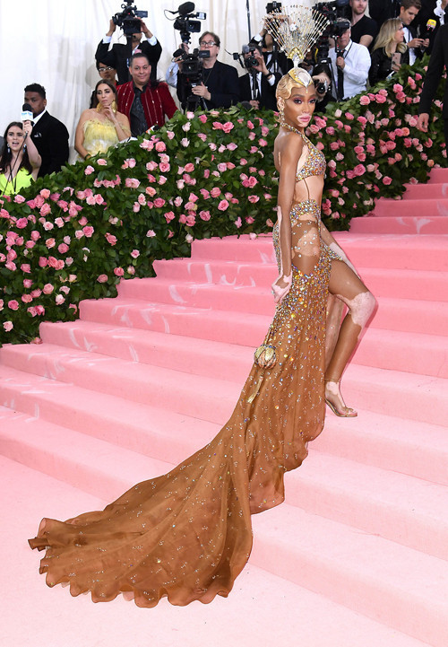 Winnie Harlow: Küçükken alay ederlerdi, şimdi milyon dolarlık servetin sahibi Winnie Harlow: Küçükken alay ederlerdi, şimdi milyon dolarlık servetin sahibi