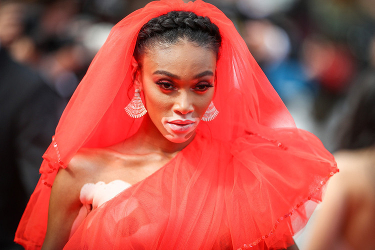Winnie Harlow: Küçükken alay ederlerdi, şimdi milyon dolarlık servetin sahibi Winnie Harlow: Küçükken alay ederlerdi, şimdi milyon dolarlık servetin sahibi