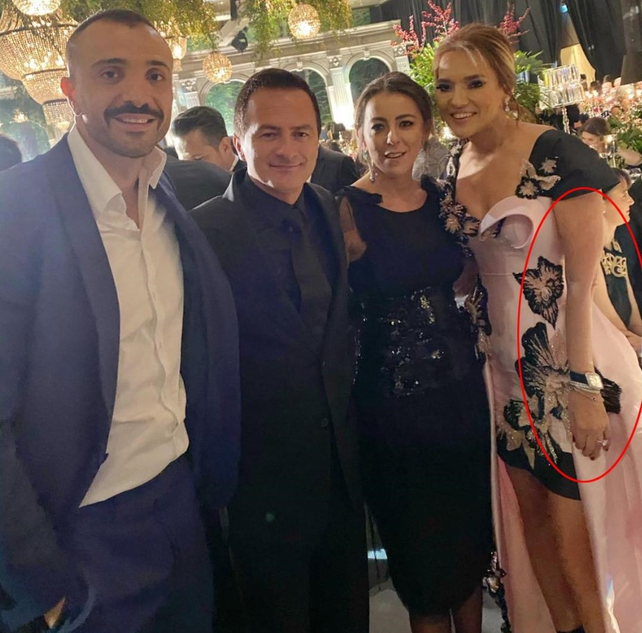 Özge Ulusoyun fotoğrafları gerçek mi Photoshop mu