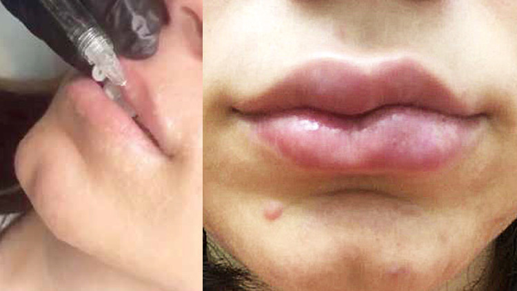 Yetuk ayollarning yuzlarida koplab sperma fotosuratlari Yetuk ayollarning yuzlarida koplab sperma fotosuratlari