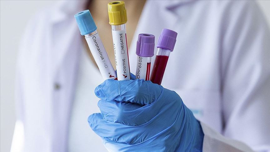 Corona virüsü hastalarında koku ve tat alma kaybı da görülebiliyor