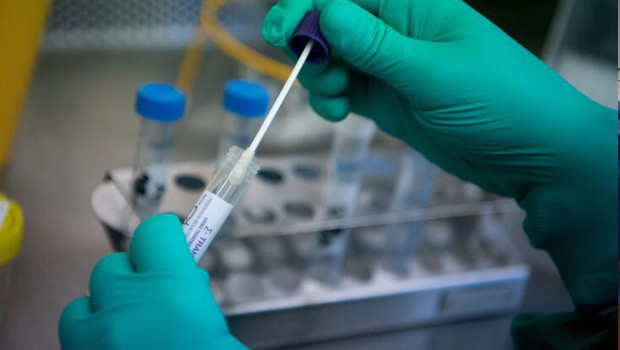 KORONAVİRÜSTEN KORUNMA YOLLARI NEDİR