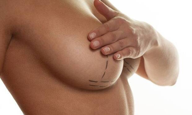 Meme küçültme yaptıran biri bebeğini emzirebilir mi