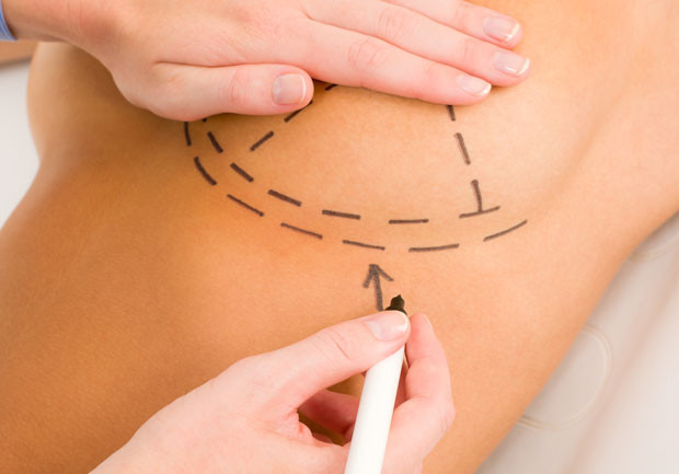 Meme küçültme estetiğinin faydaları