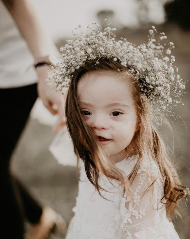 Down sendromlu İnci’nin annesi: “Kızım yaşama amacımı değiştirdi”