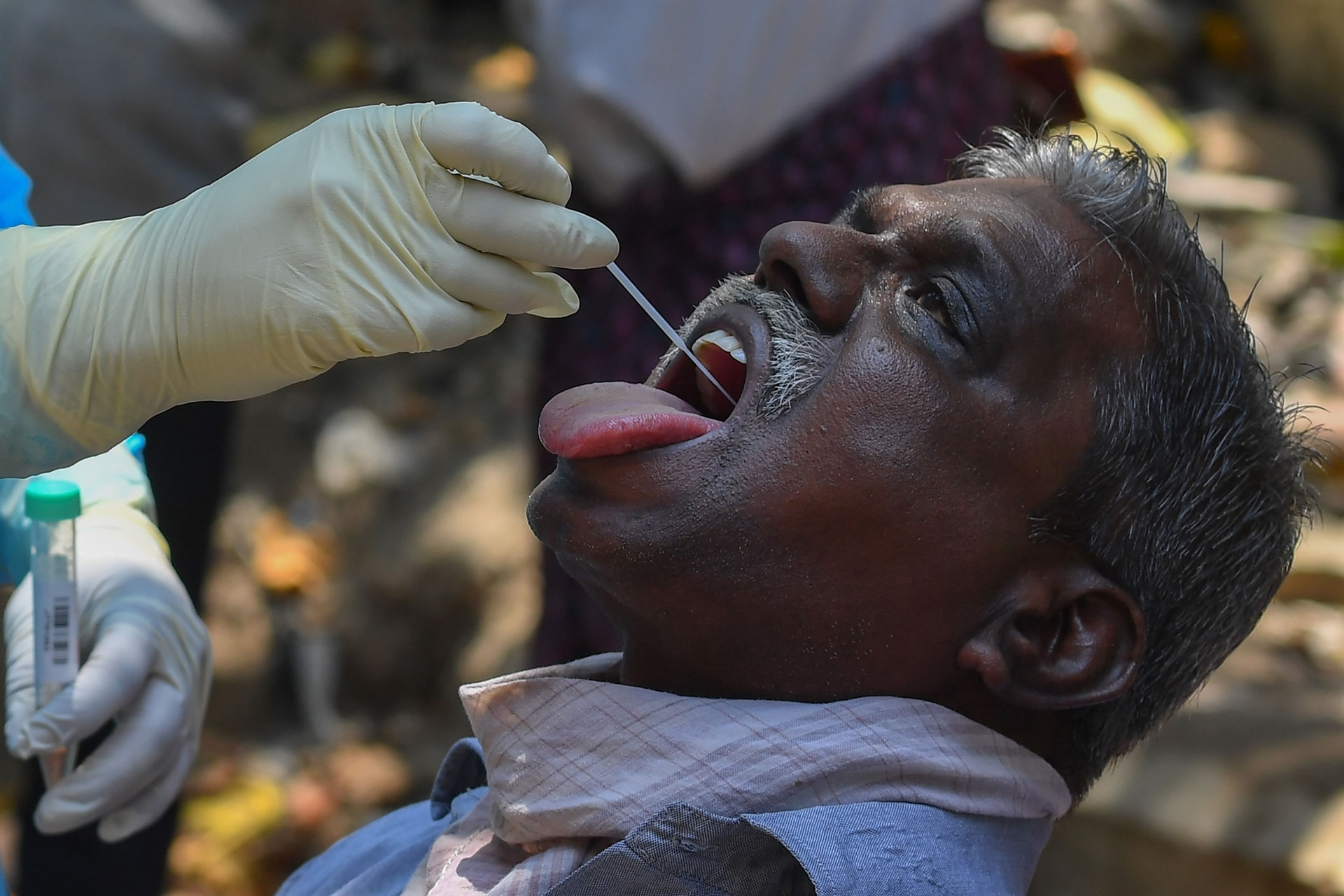 Trump: Diğer ülkeler sayıları gizliyor