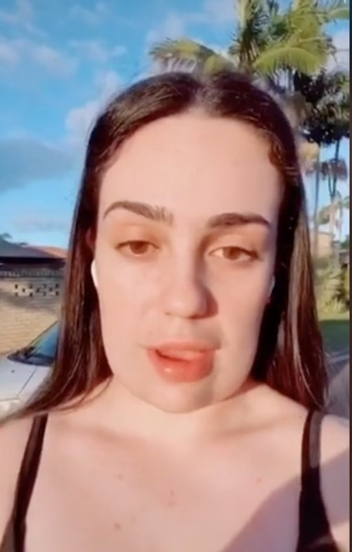 Estetik yaptırdı, yüzü kare oldu Onu gören yakınları şok geçirdi