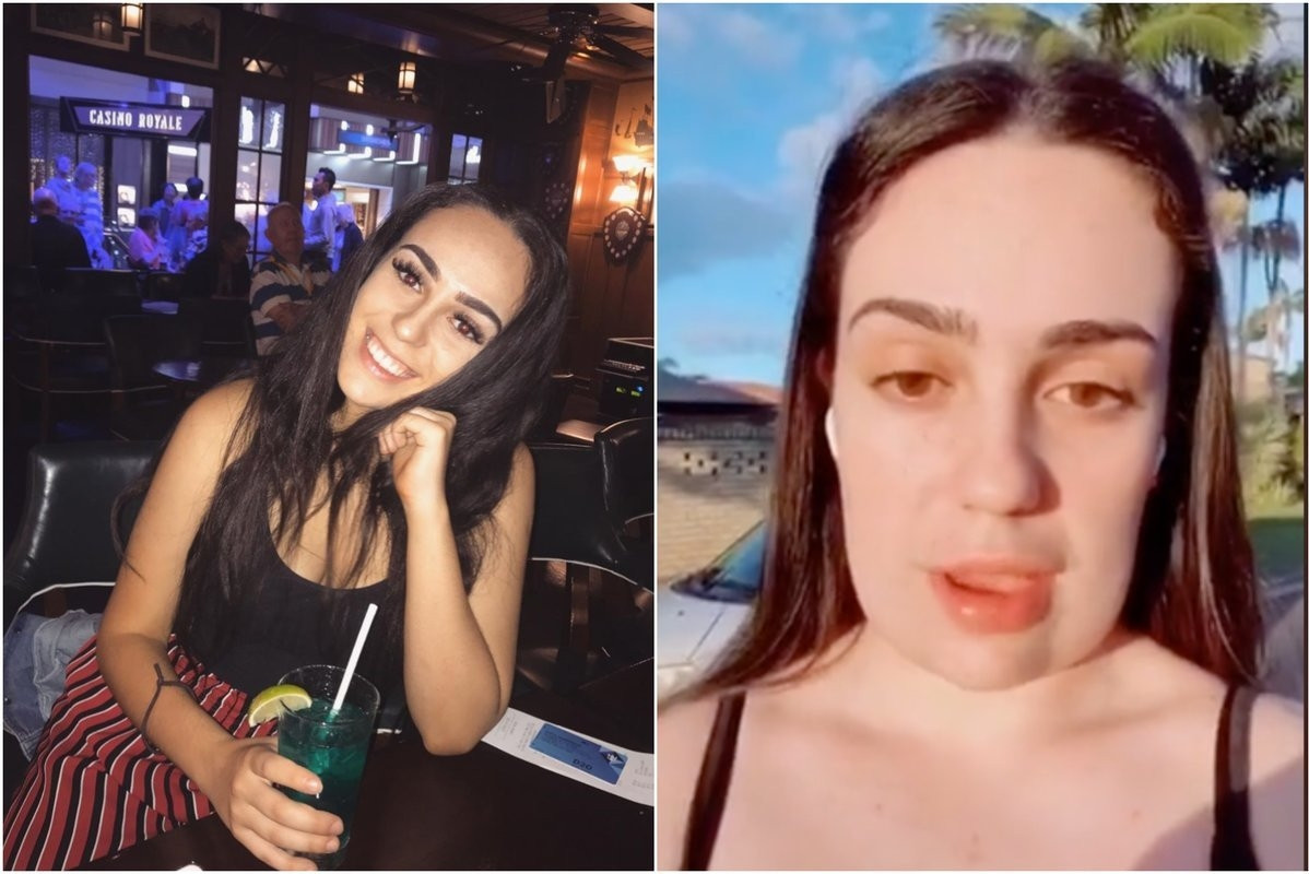 Estetik yaptırdı, yüzü kare oldu Onu gören yakınları şok geçirdi