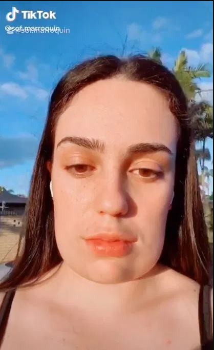 Estetik yaptırdı, yüzü kare oldu Onu gören yakınları şok geçirdi