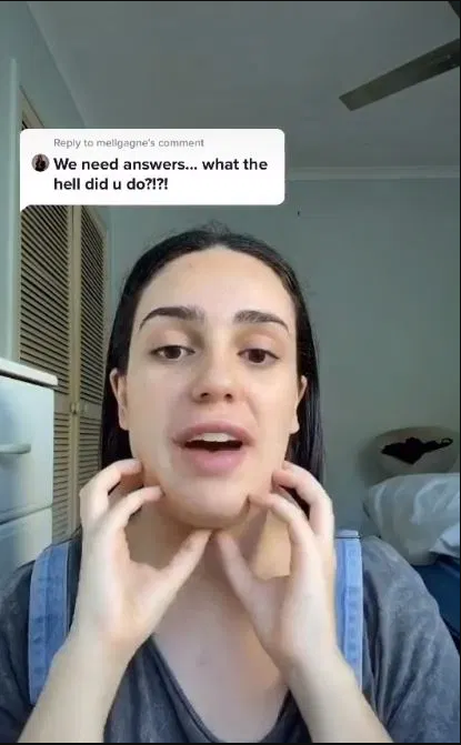 Estetik yaptırdı, yüzü kare oldu Onu gören yakınları şok geçirdi